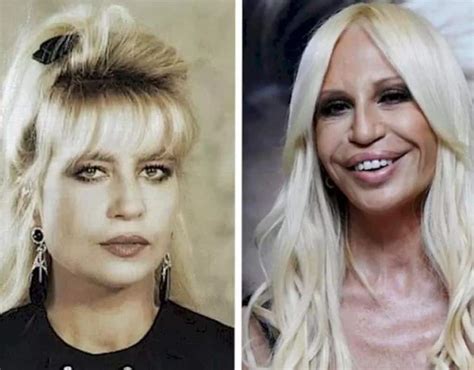 donatella versace e|donatella versace face what happened.